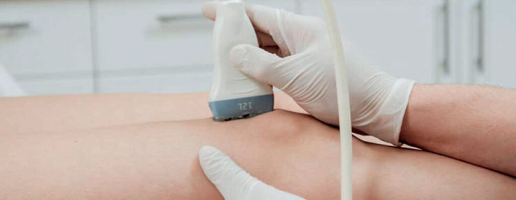 Exame de ultrassom Doppler vascular nas pernas